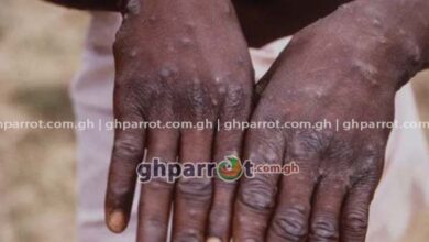 MPOX, GHANA HEALTH SERVICE, MPOX CASES IN GHANA,