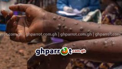 mpox,